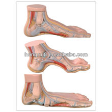 ISO Set of Normal foot, Flat foot and Arched Foot Model